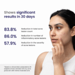 Acne Treatment Gel with AHA & BHA - Clarifying Formula for Clear Skin