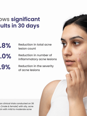 Acne Treatment Gel with AHA & BHA - Clarifying Formula for Clear Skin