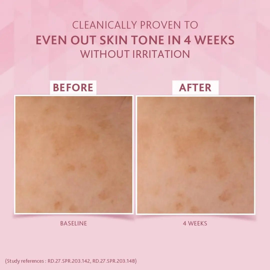 Cetaphil Night Cream Results